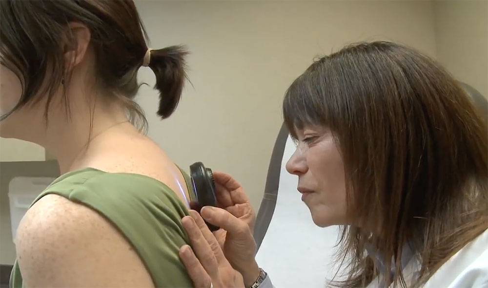 Skin cancer screening by Siteman  doctor